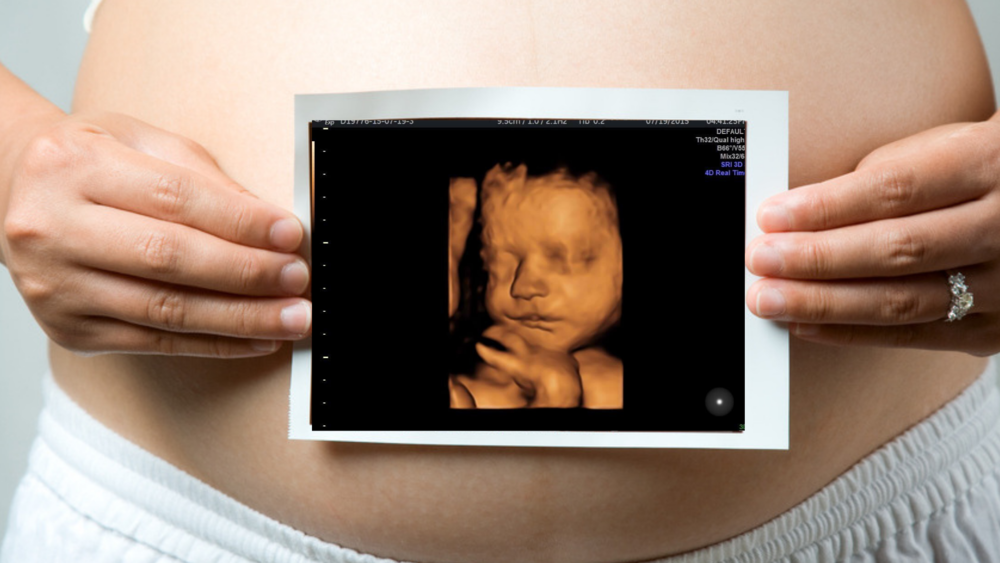 Top 3D 4D Ultrasound Places In Adelaide KIDDO Mag